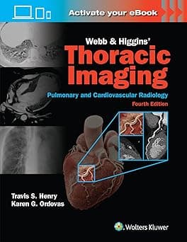Webb and Higgins Thoracic Imaging  4th/2025