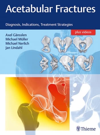 Acetabular Fractures 1st/2018