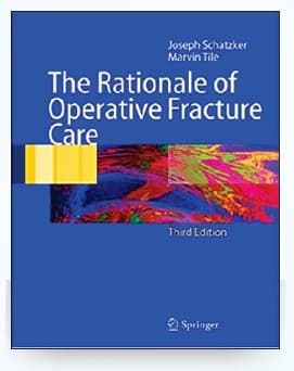 The Rationale of Operative Fracture Care 3rd/2022 (SAE)