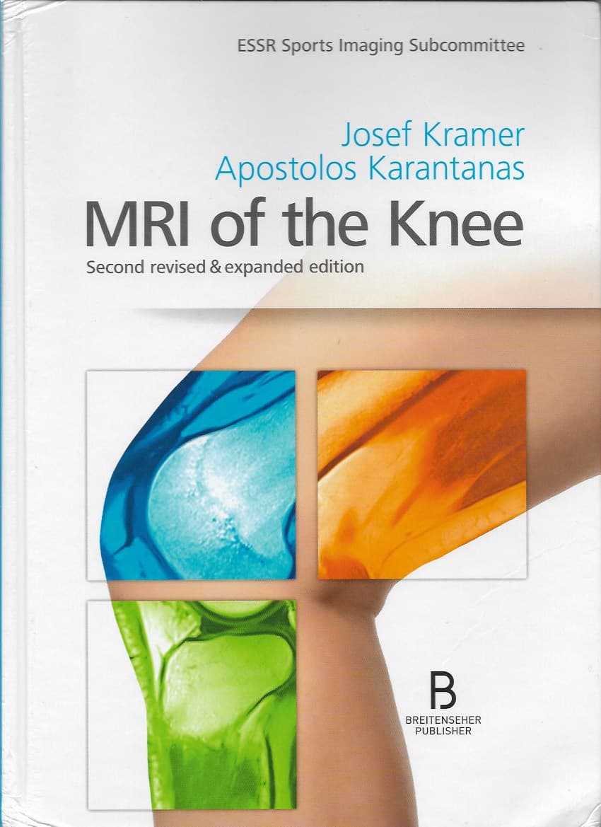 MRI of the Knee 2nd/2020