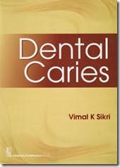 Dental Caries 1st/2016