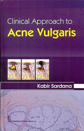 Clinical Approach to Acne Vulgaris 1st/2015