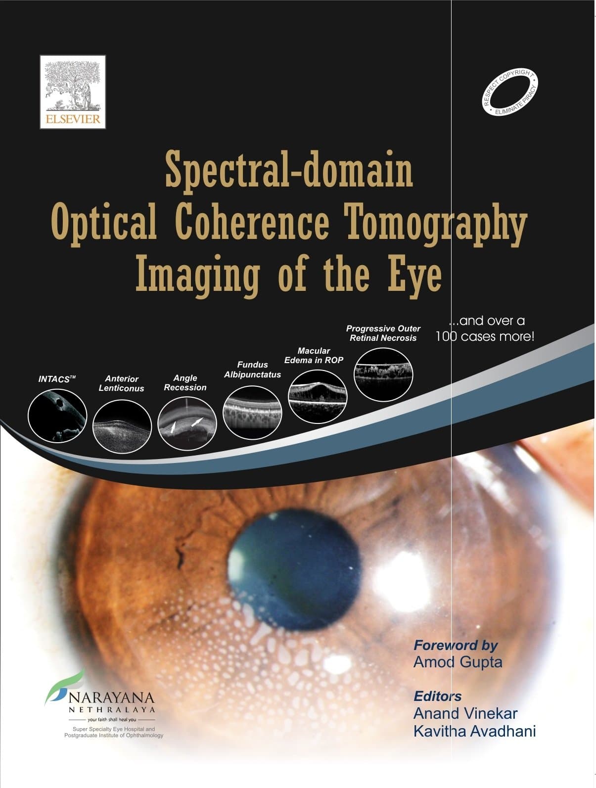Spectral Domain Optical Coherence Tomography Imaging of the Eye 1st/2013