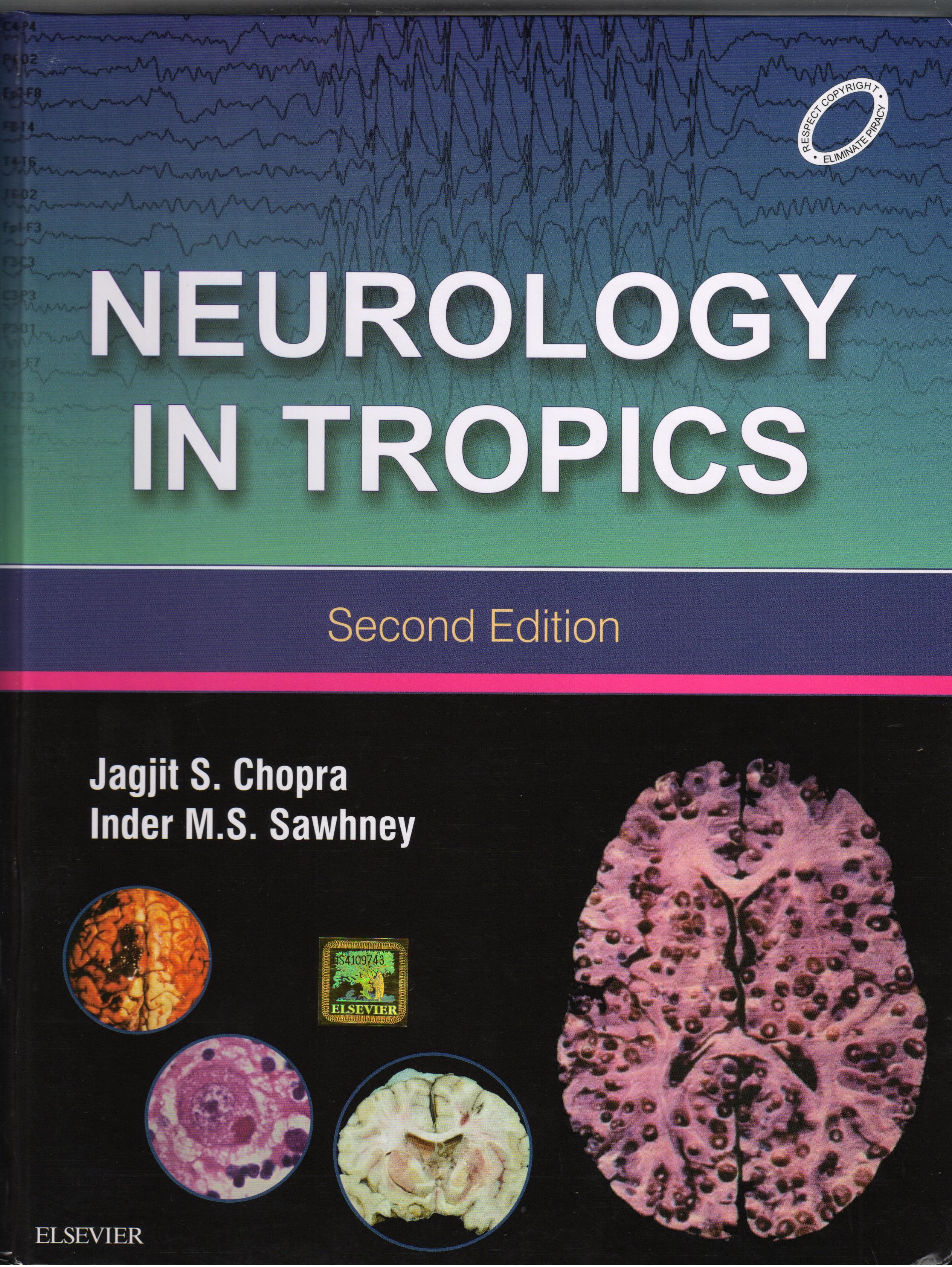 Neurology In Tropics 2nd/2015