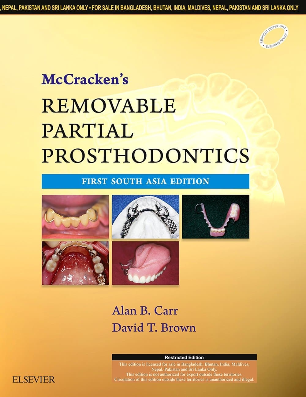McCracken's Removable Partial Prosthodontics 1st/2016