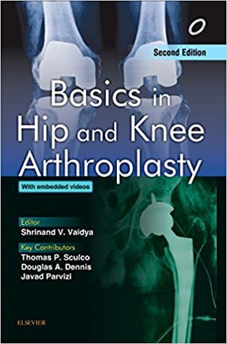 Basics in Hip and Knee Arthroplasty 2nd/2017
