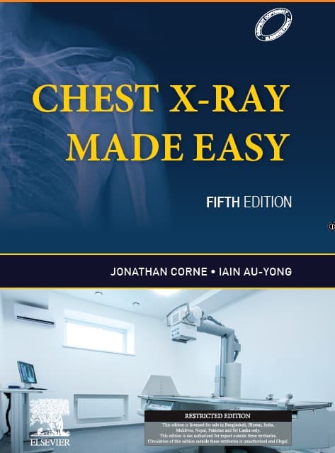 Chest X-Ray Made Easy 5th SAE/2023