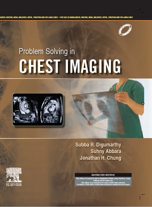 Problem Solving in Chest Imaging 1st/2023