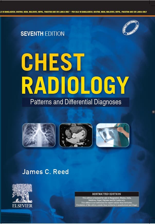 Chest Radiology Patterns and Differential Diagnoses 7th SAE/2023