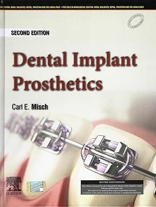 Dental Implant Prosthetics 2nd SAE/2024