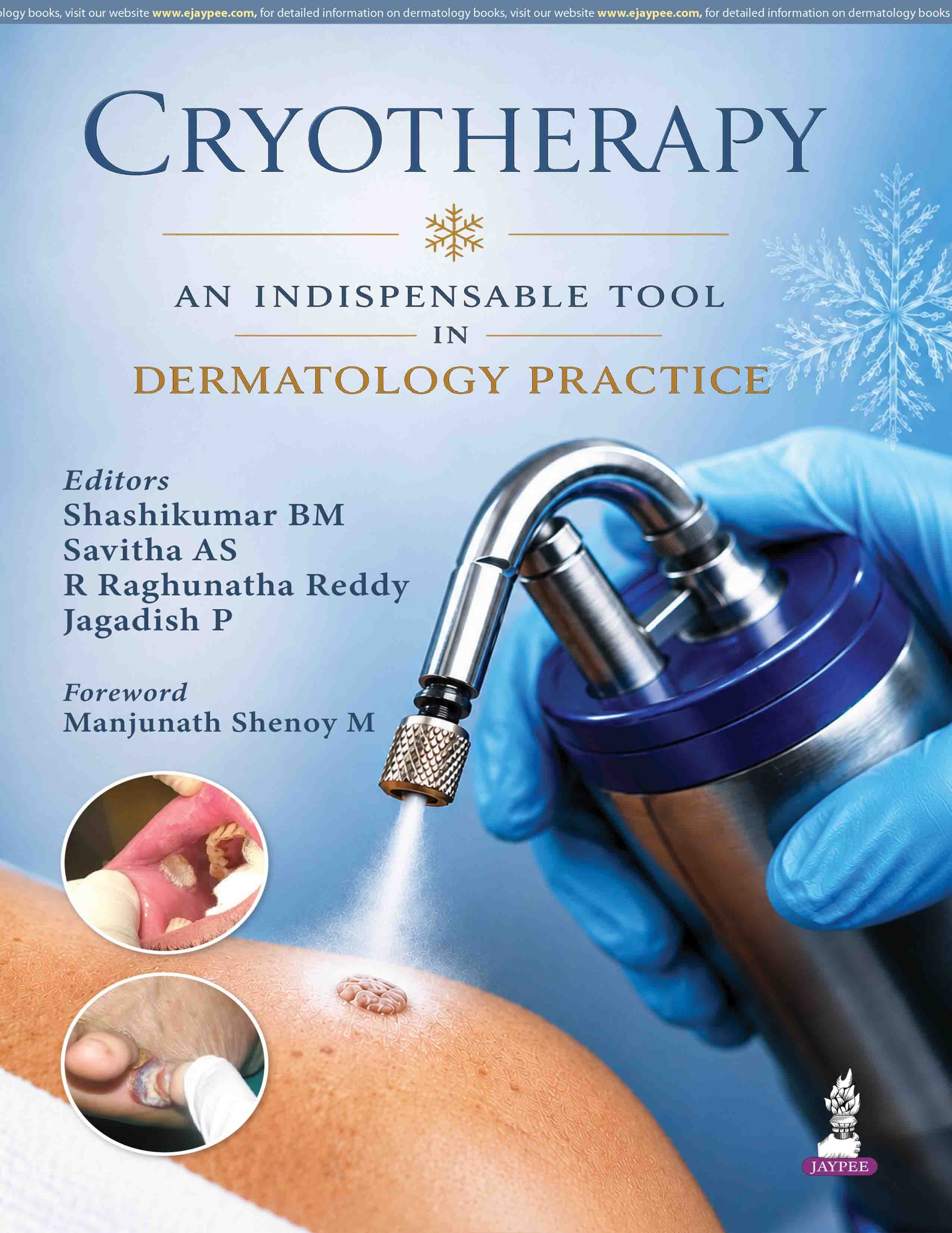 Cryotherapy: An Indispensable Tool in Dermatology Practice 1st/2027