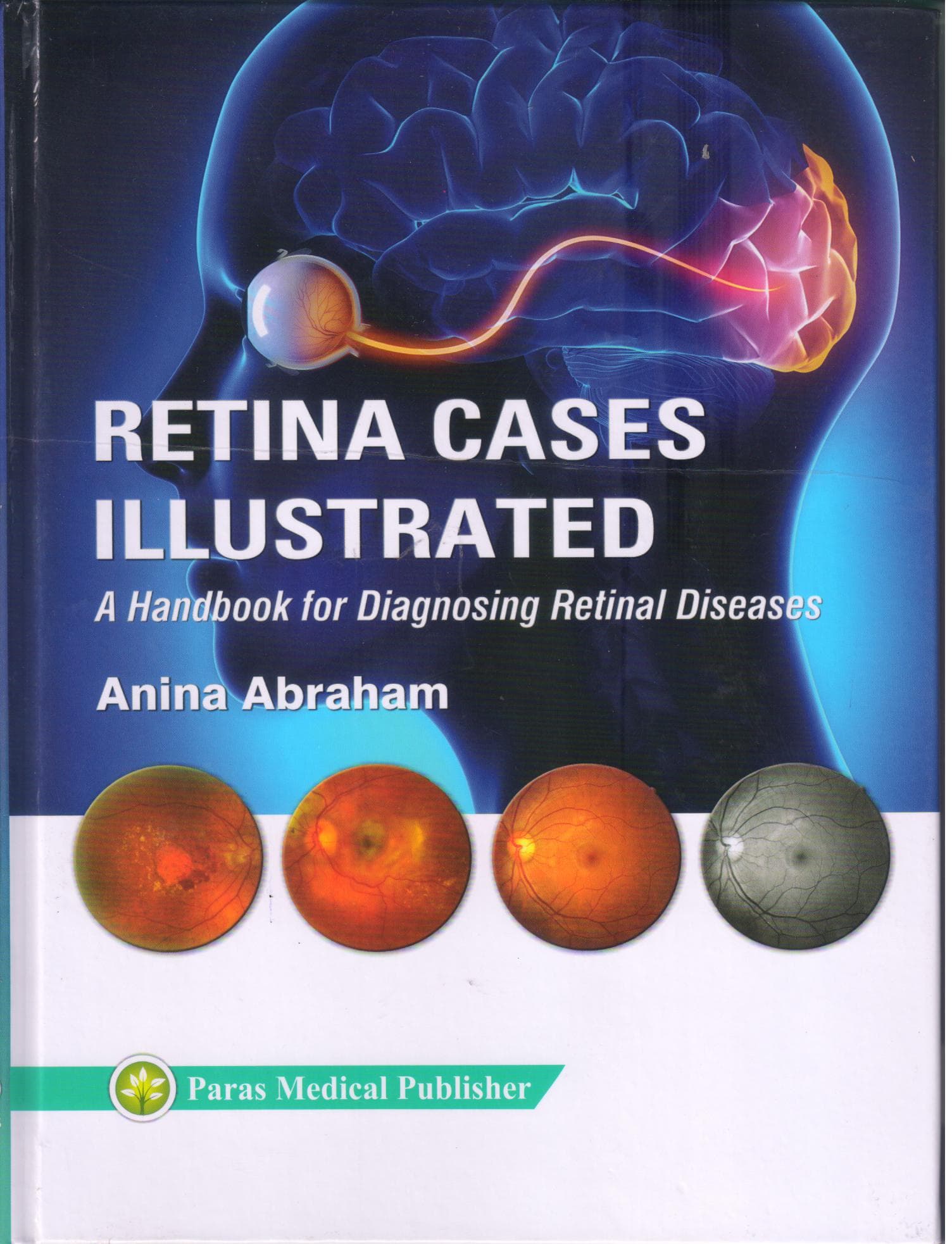 Retina Cases Illustrated 1st/2019