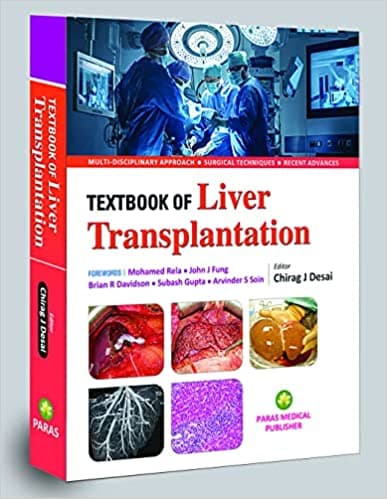 Textbook of Liver Transplantation 1st/2023