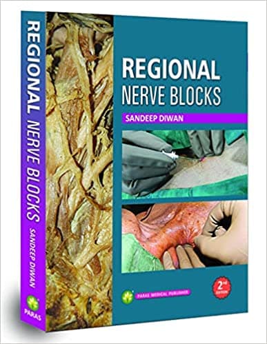 Regional Nerve Blocks 2nd/2023