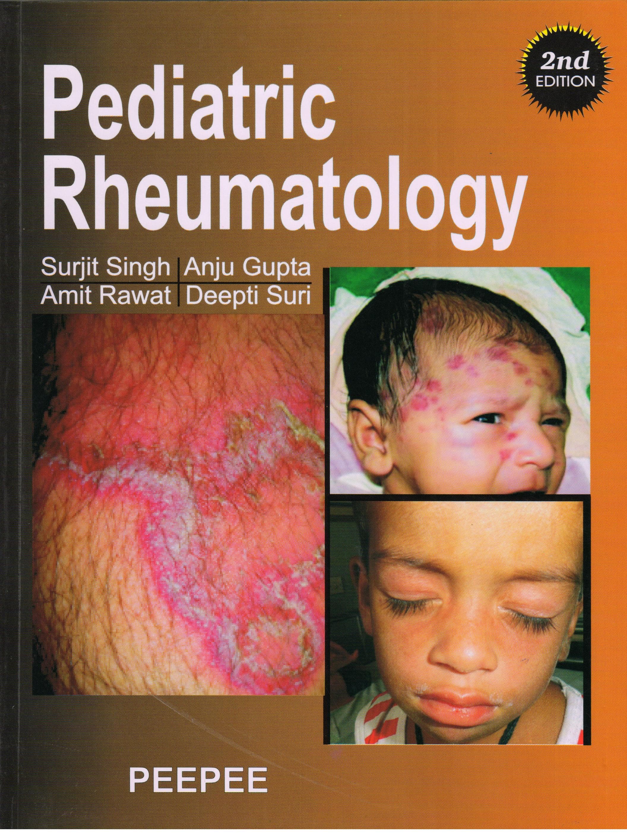 Pediatric Rheumatology 2nd/2015