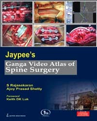 Jaypee's Ganga Video Atlas of Spine Surgery 1st/2010
