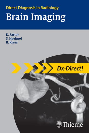 Direct Diagnosis in Radiology: Brain Imaging 1st/2007