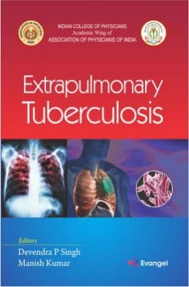 Extrapulmonary Tuberculosis 1st/2019