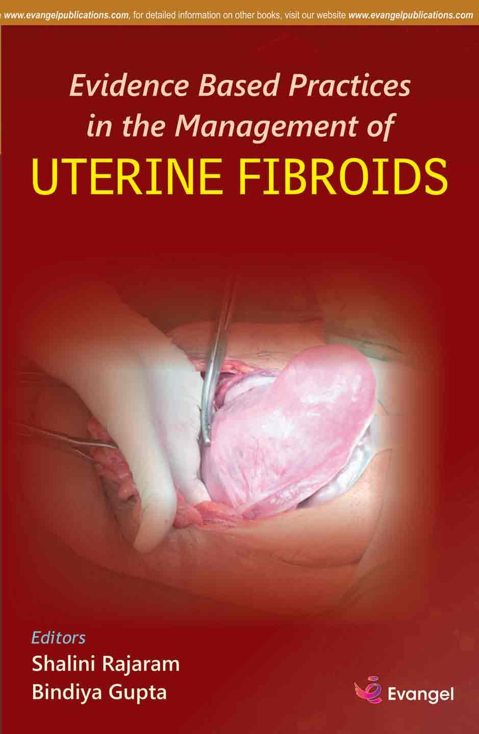 Evidence Based Practices in the Management of Uterine Fibroids 1st/2019