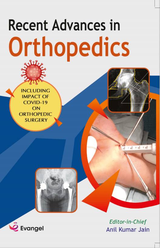 Recent Advances in Orthopedics 1st/2021