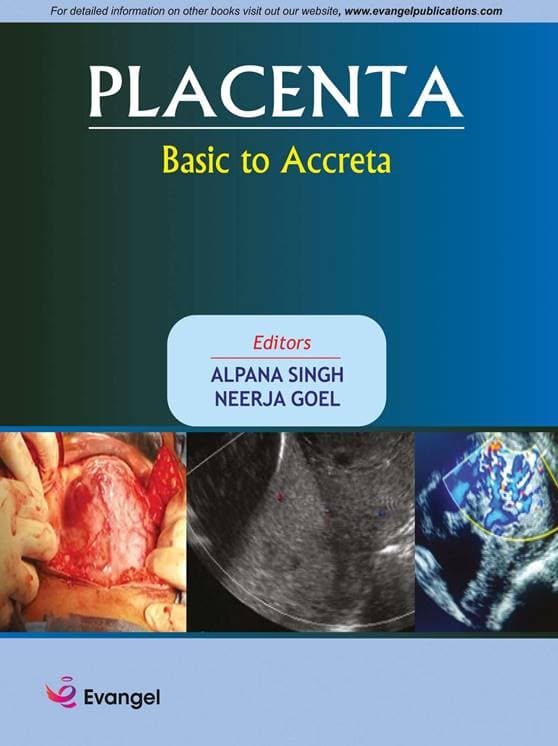 Placenta: Basic to Accreta 1st/2020