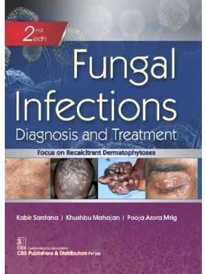 Fungal Infections Diagnosis and Treatment 2nd/2021