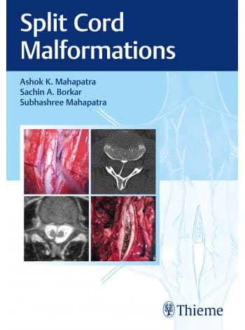 Split Cord Malformations 1st/2021