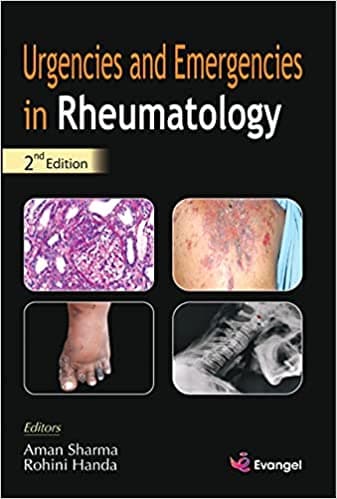 Urgencies and Emergencies in Rheumatology 2nd/2021