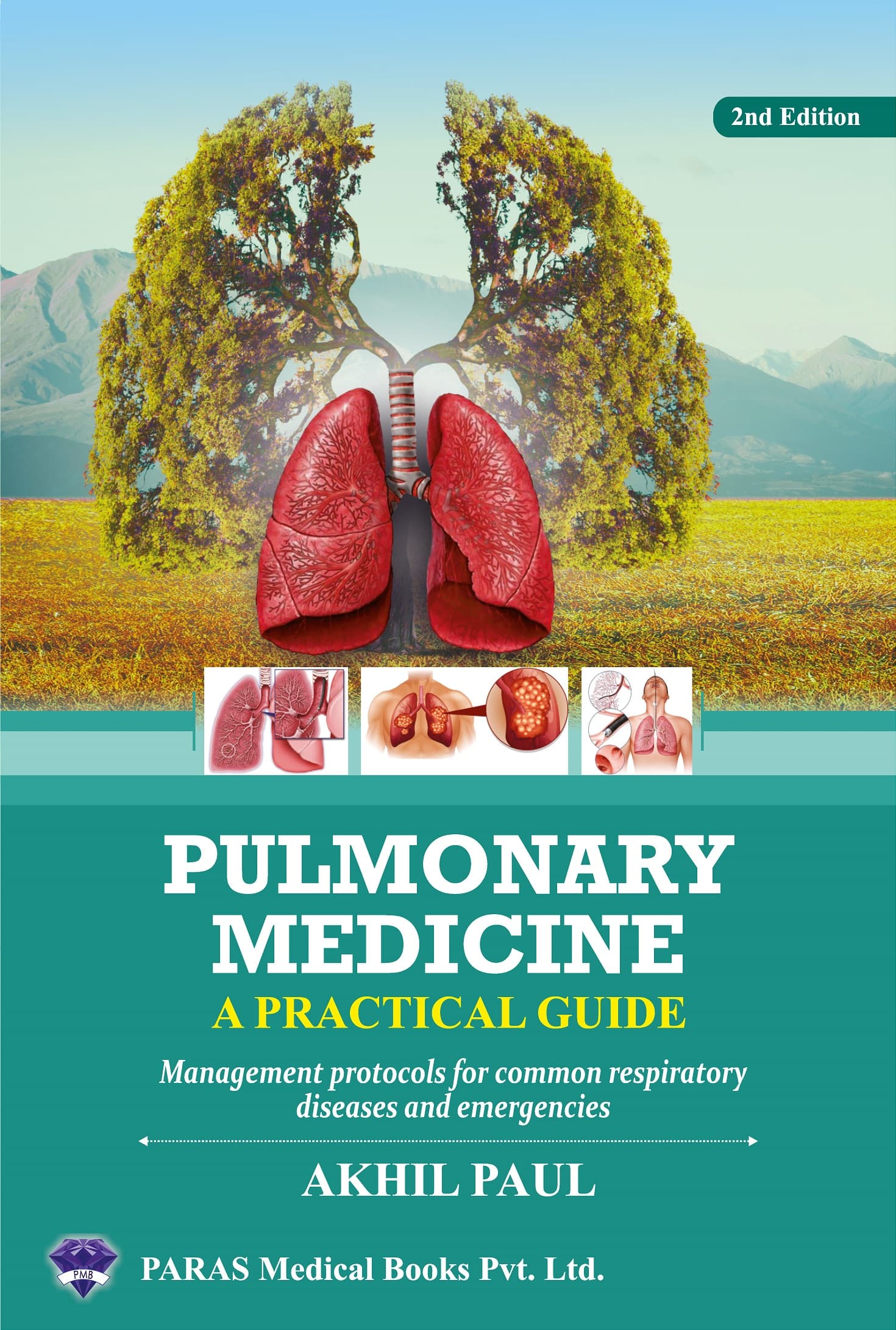 Pulmonary Medicine A Practical Guide 2nd/2024