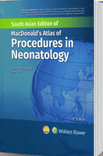 Macdonalds Atlas of Procedures In Neonatology 6th SAE/2024