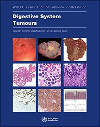 WHO Classification of Tumours: Digestive System Tumours 5th/2019
