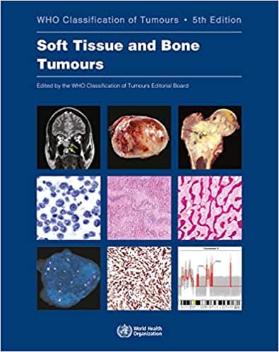 WHO Classification of Tumours: Soft Tissue and Bone Tumours 5th/2020
