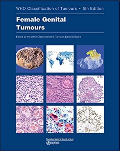 WHO Classification of Tumours: Female Genital Tumours 5th/2020