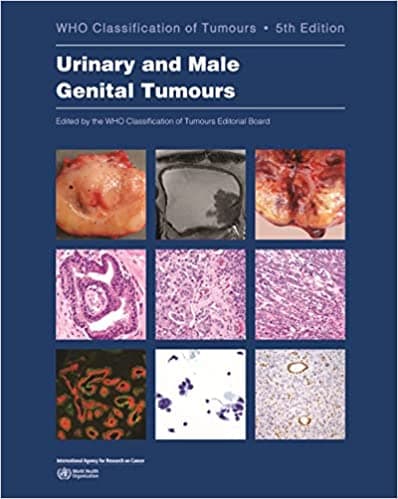 WHO Classification of Tumours : Urinary and Male Genital Tumours 5th/2022