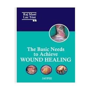 Basic Needs to Achieve Wound Healing