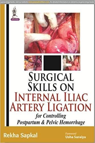 Surgical Skills on Internal Iliac Artery Ligation 1st/2015
