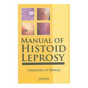 Manual of Histoid Leprosy