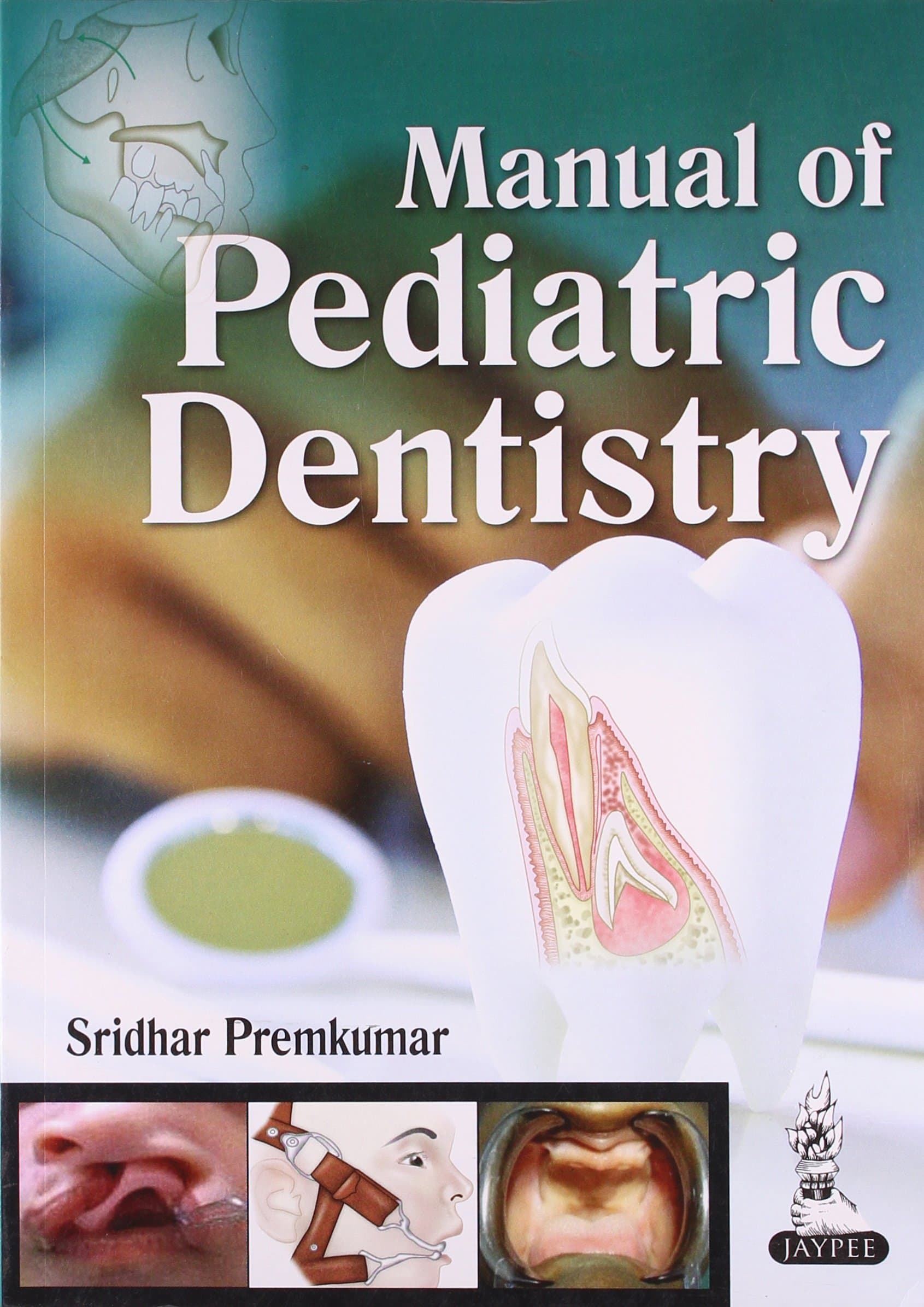 Manual of Pediatric Dentistry 1st/2014