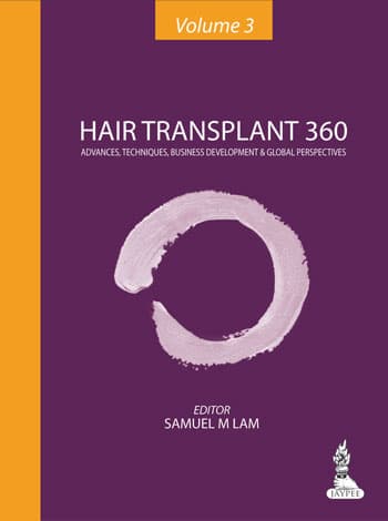Hair Transplant 360 1st/2014 (Vol 3)