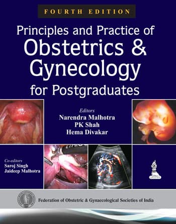 Principles and Practice of Obstetrics and Gynecology for Postgraduates 4th/2014