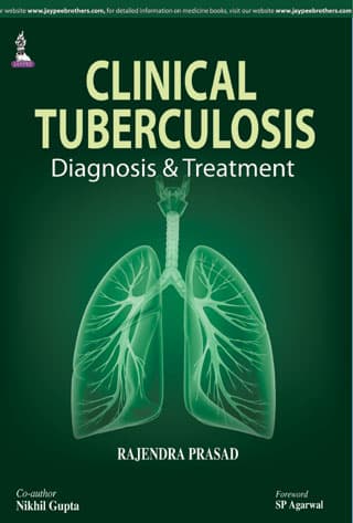 Clinical Tuberculosis Diagnosis and Treatment 1st/2015