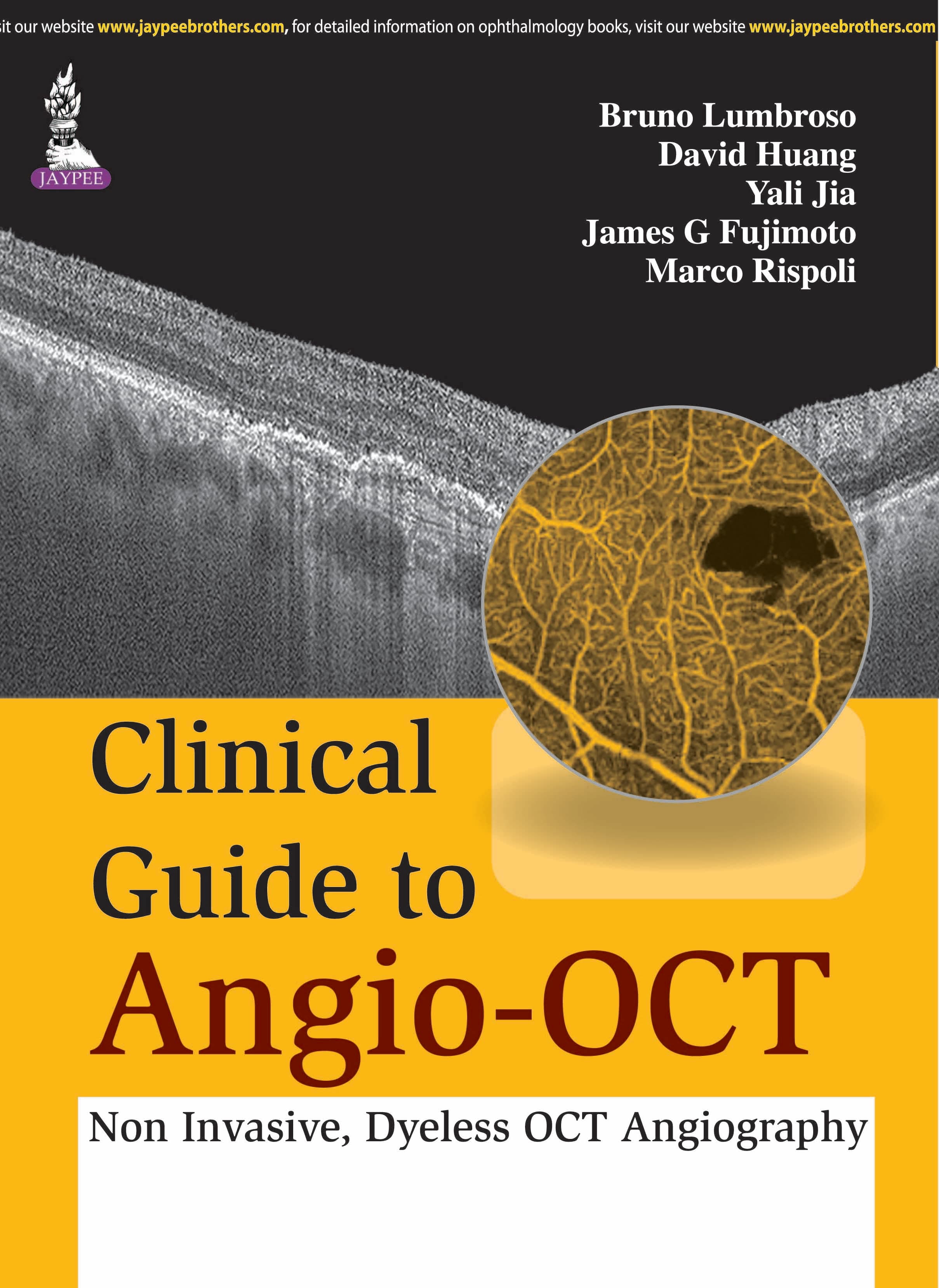 Clinical Guide to Angio-OCT 1st/2015