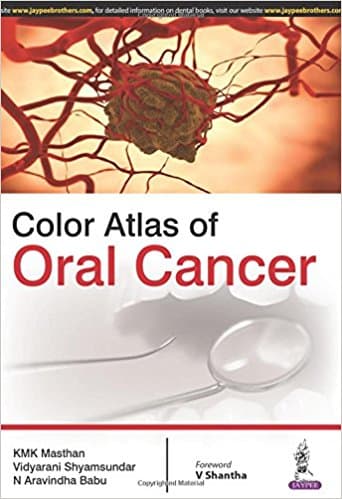 Color Atlas of Oral Cancer 1st/2016