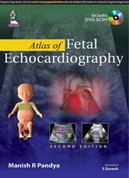 Atlas of Fetal Echocardiography 2nd/2015