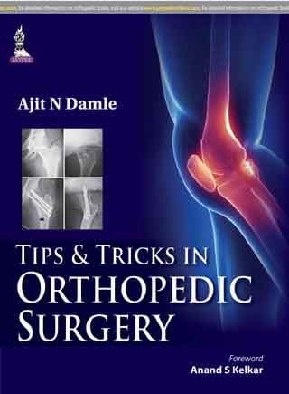 Tips and Tricks in Orthopedic Surgery 1st/2015