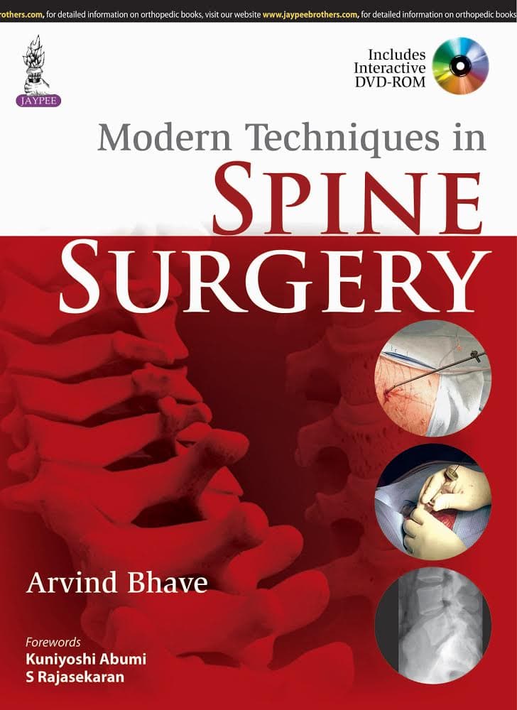 Modern Techniques in Spine Surgery 1st/2015