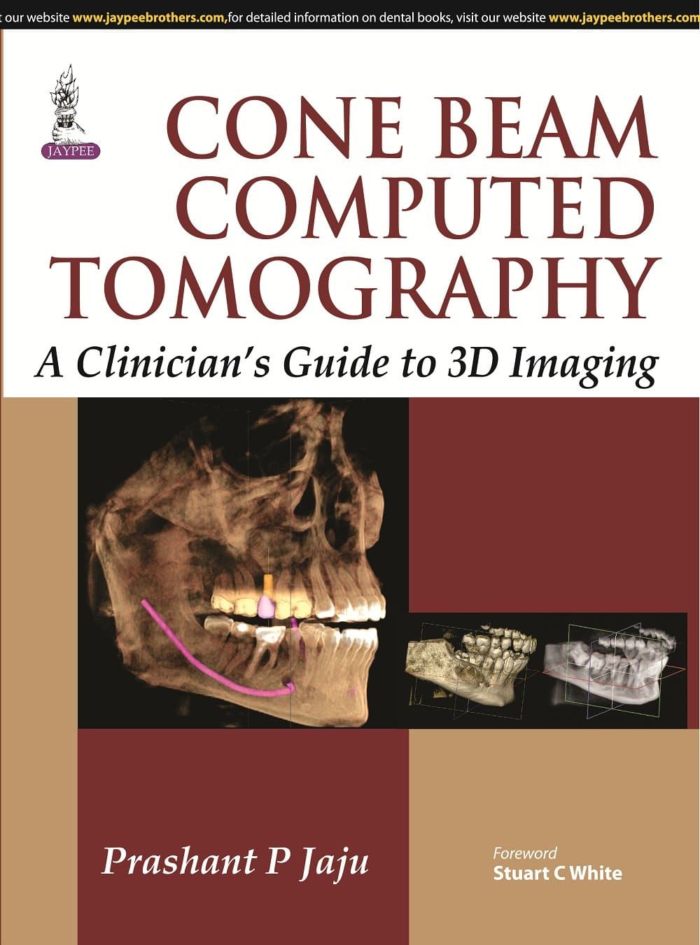 Cone Beam Computed Tomography 1st/2015