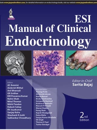 ESI Manual Of Clinical Endocrinology 2nd/2015