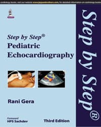 Step by Step Pediatric Echocardiography 3rd/2015