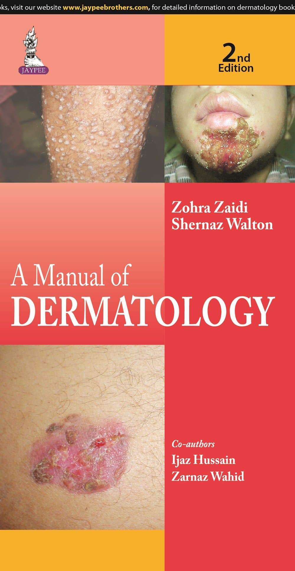 Manual of Dermatology 2nd/2015